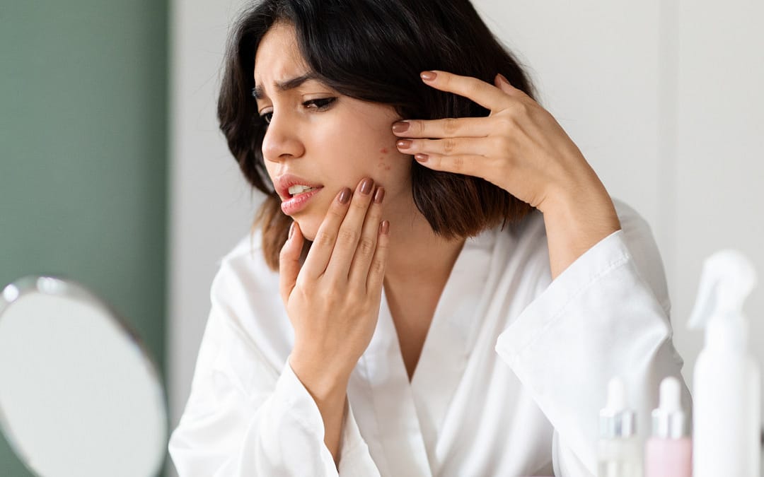 Ingredient in Popular Acne Products Linked to Cancer