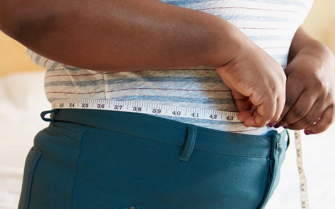 Black People Less Likely to Undergo Weight-Loss Surgery