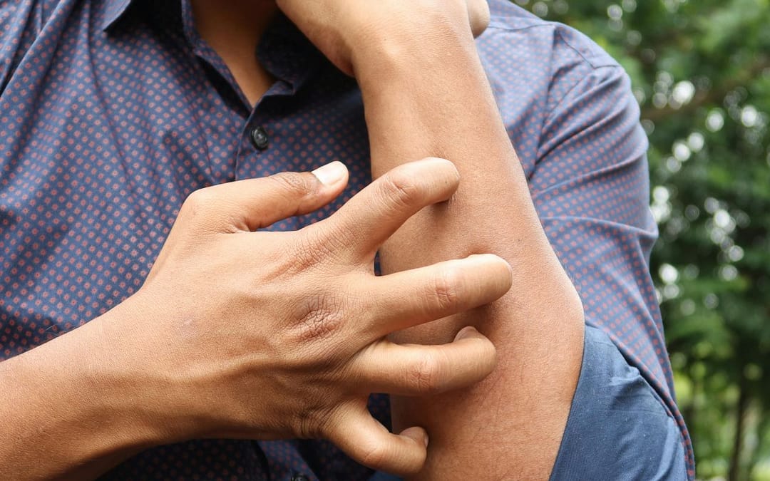 Itch or Pain? Your Brain Knows the Difference—Here’s How