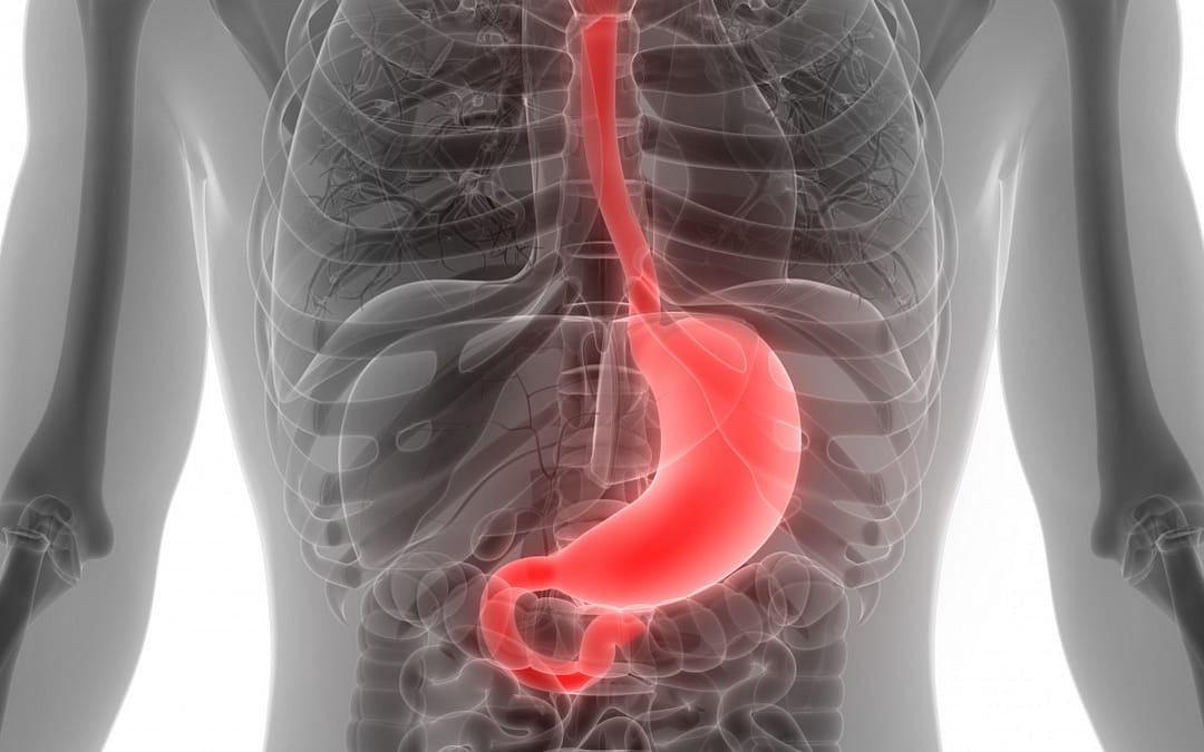 Turning Point In Stomach Cancer: Early-Stage Diagnoses Now More Common