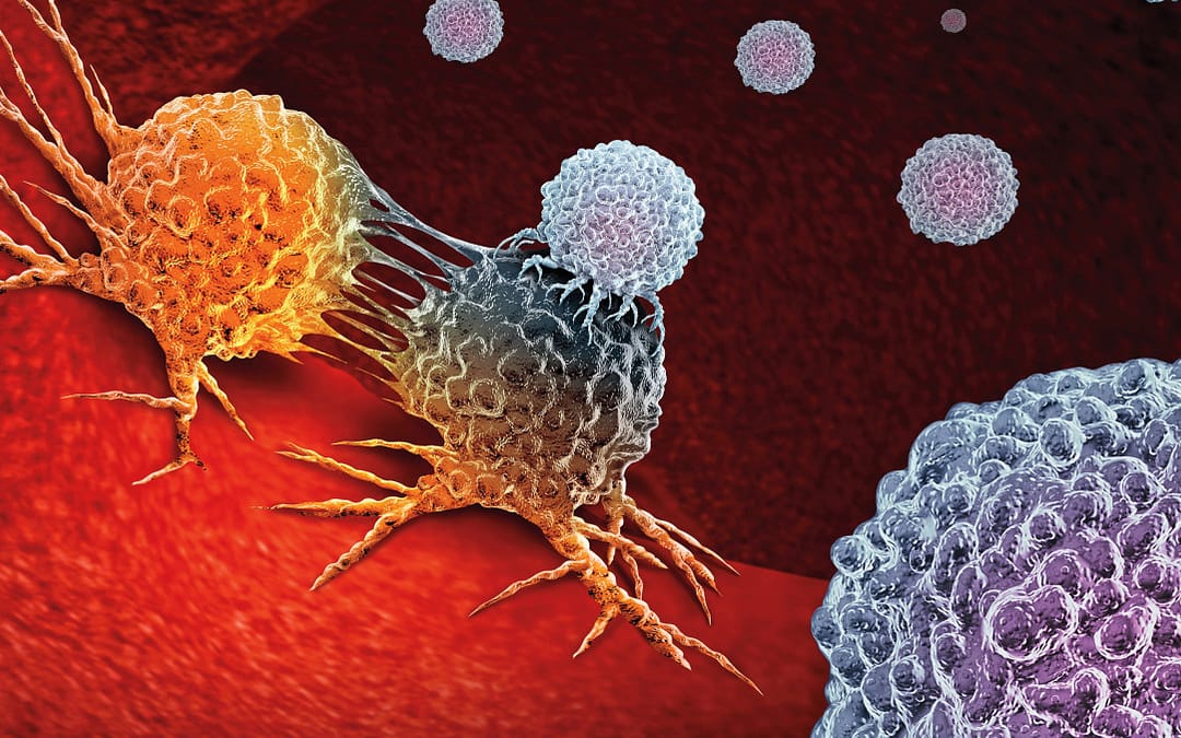 Imfinzi Immunotherapy Plus Chemotherapy Reduces Risk of Stomach Cancer Progression