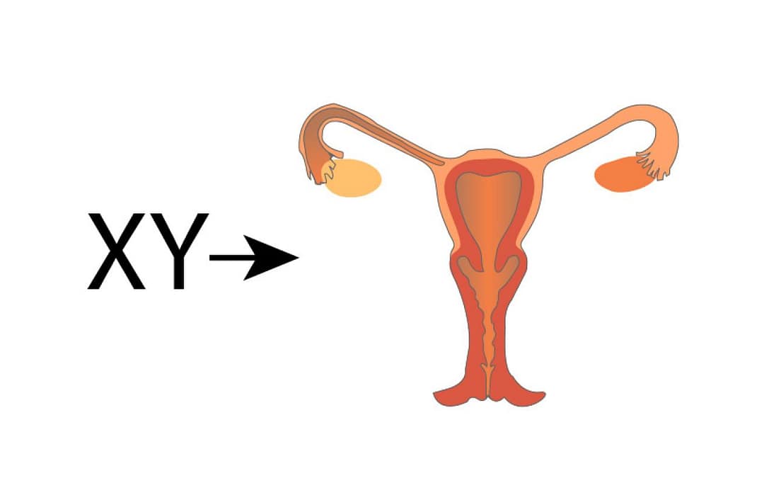 Iron Deficiency Can Cause Sex Reversal in Mouse Fetuses