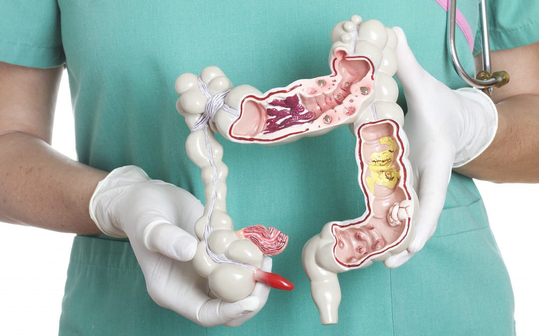 Alarming Rise in Many Gastrointestinal Cancers in Young People