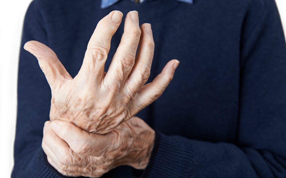 Living Well With Rheumatoid Arthritis