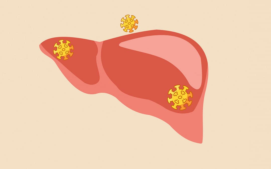 WHO Urges Action on Hepatitis, Announcing Hepatitis D as Carcinogenic