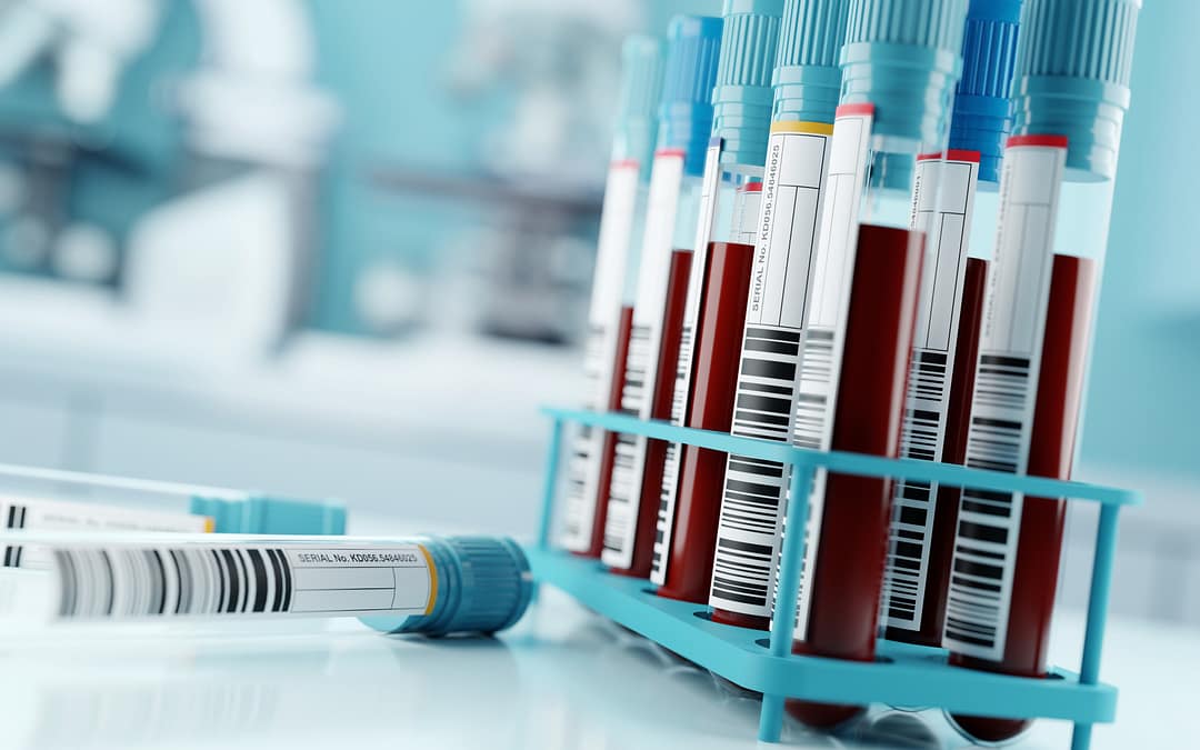 How Well Can Blood Tests Detect Multiple Cancers Early, When They’re Easier to Treat?