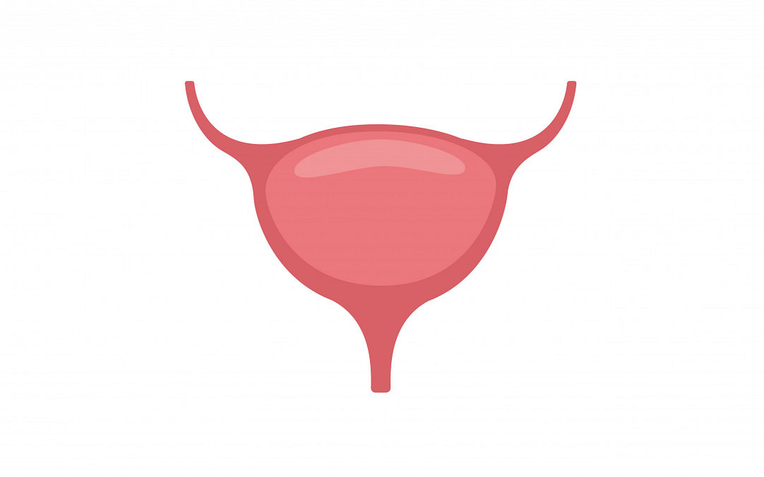 Bladder Cancer: What You Need to Know