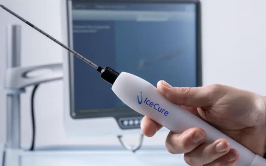 FDA Approves First Cryotherapy for Breast Cancer