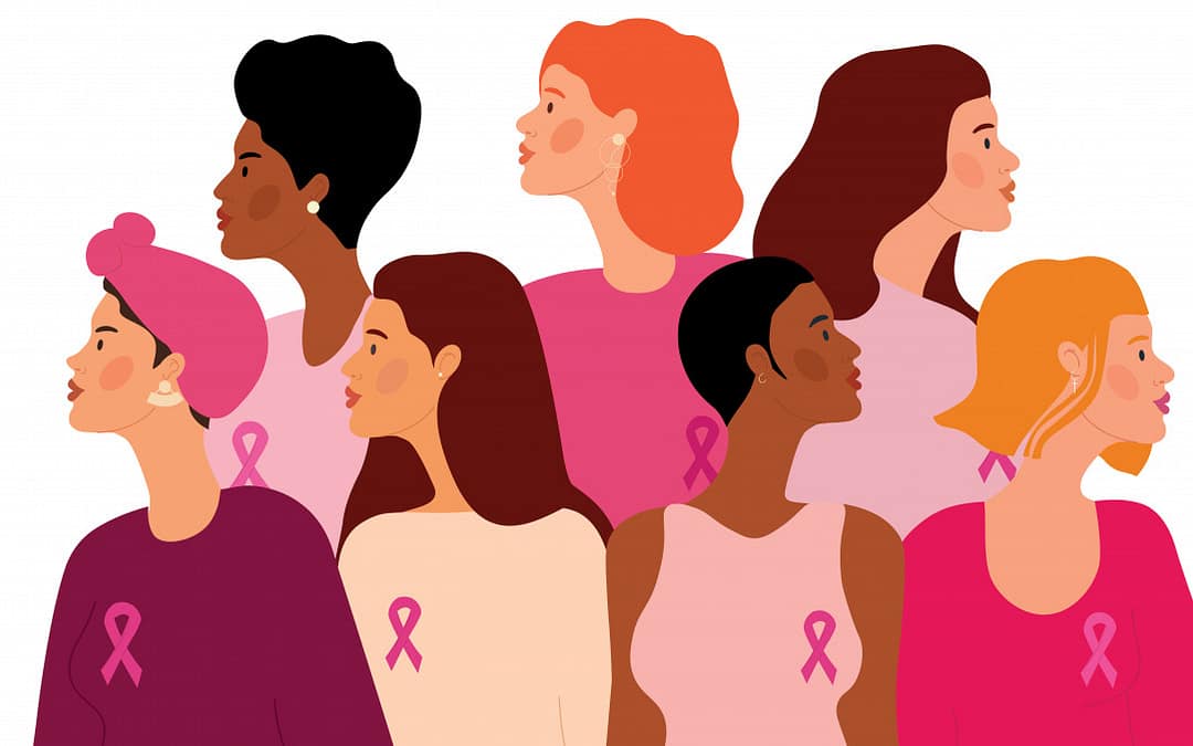 A Polygenic Risk Score May Predict Future Breast Cancer in Patients With Early-Stage Diagnoses