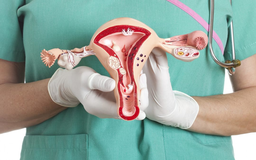 One Surgery Could Prevent Most Ovarian Cancers, Surgeons Say