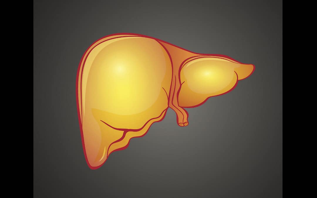 MASLD Raises Liver Cancer Risk After Hepatitis C Cure
