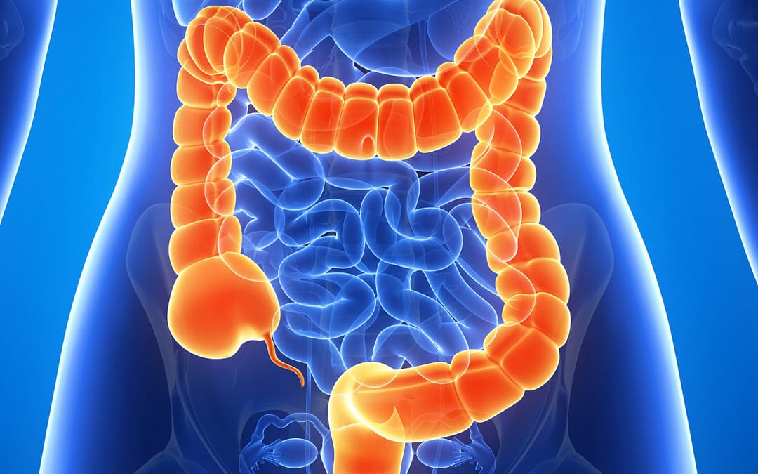 What’s Your Risk for Colorectal Cancer? Find Out With This Free Online Tool