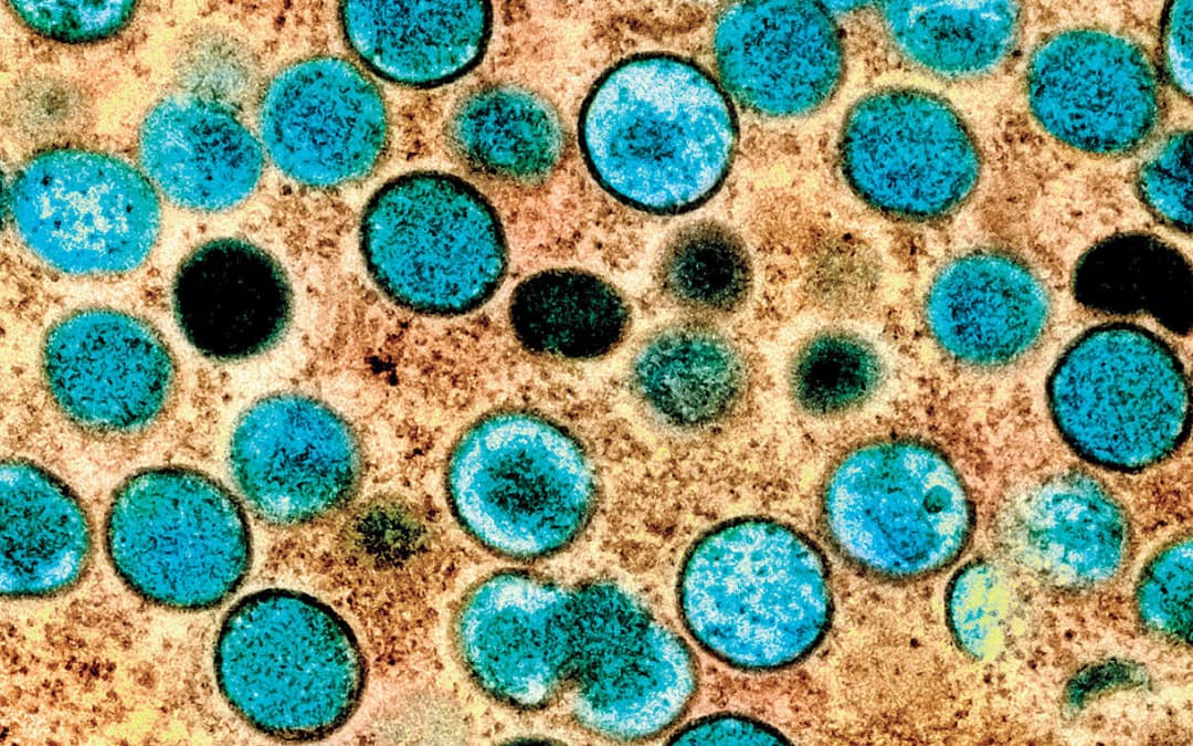 Hidden Mpox Exposure Detected in Healthy Nigerian Adults, Revealing Under-Recognized Transmission