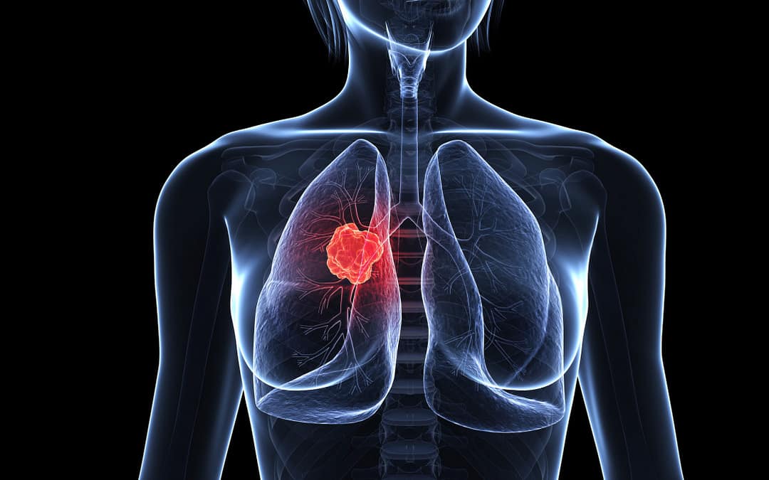 Breast Cancer Hijacks the Lung Repair System to Fuel Tumor Growth, Study Finds