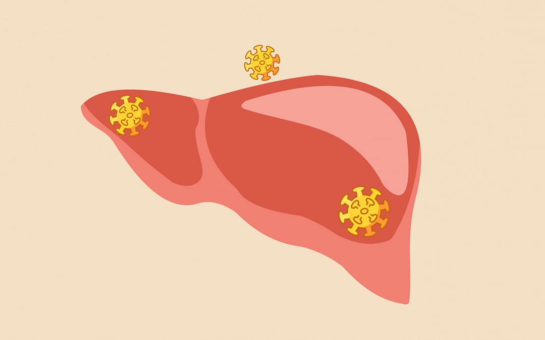 FDA Approves Hepcludex as First Hepatitis D Treatment