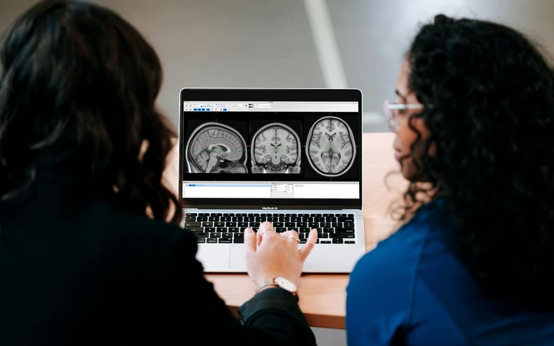 Depression Doesn’t Just Affect the Thinking Brain