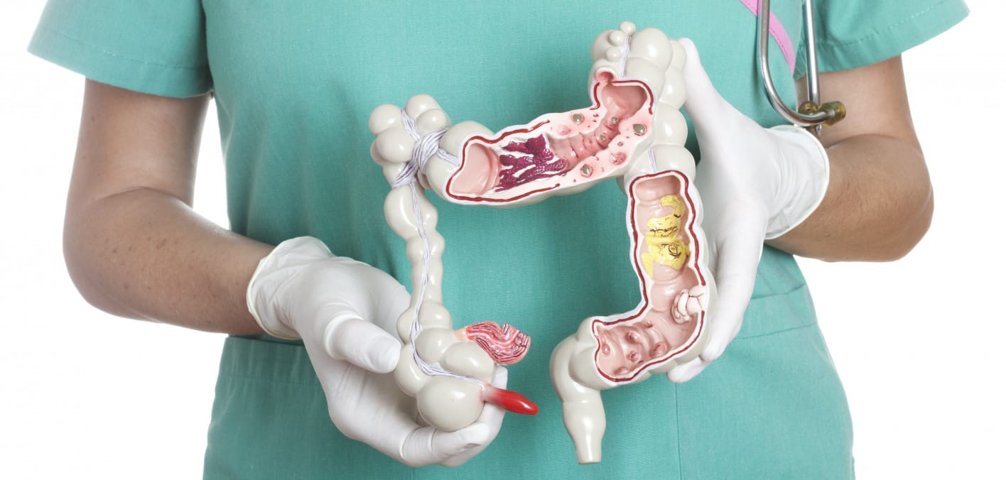 alarming-rise-in-many-gastrointestinal-cancers-in-young-people