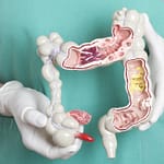 alarming-rise-in-many-gastrointestinal-cancers-in-young-people